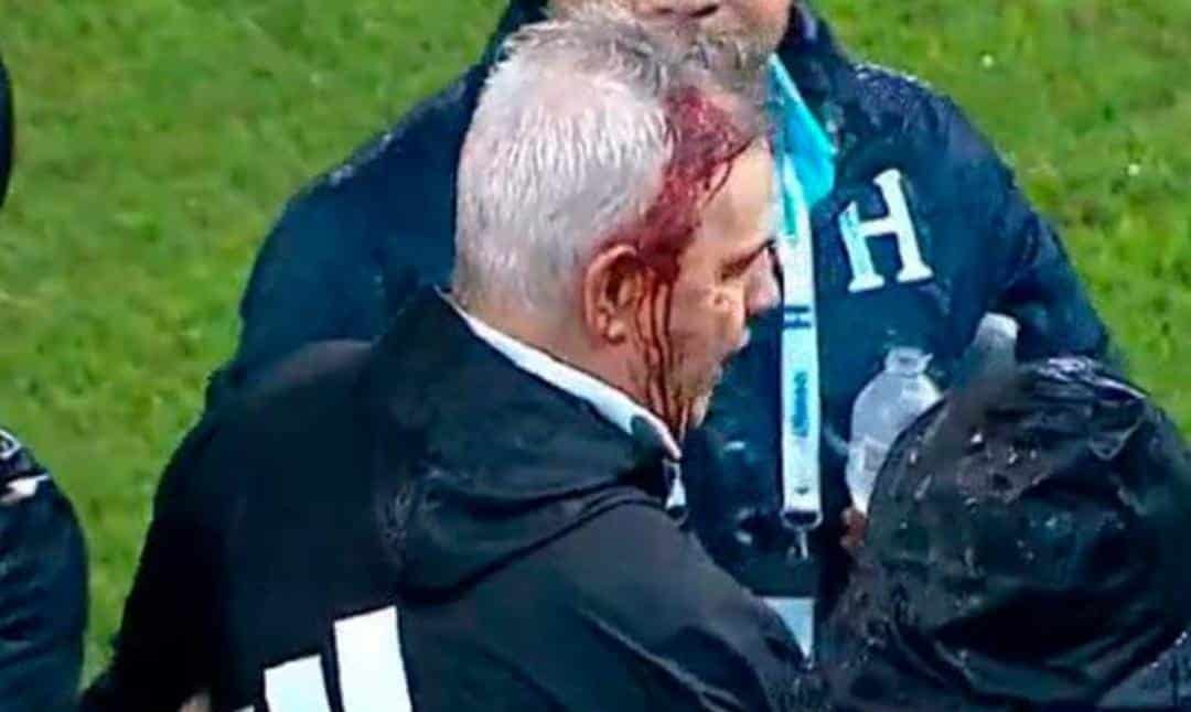 JAVIER AGUIRRE FUE AGREDIDO POR LA AFICIÓN DE HONDURAS EN LA IDA DE CUARTOS DE FINAL FRENTE A MÉXICO